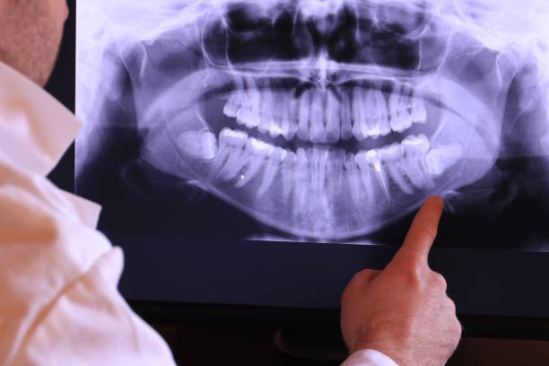 Best Urgent Care for Lost Fillings or Crowns in Macom, IL